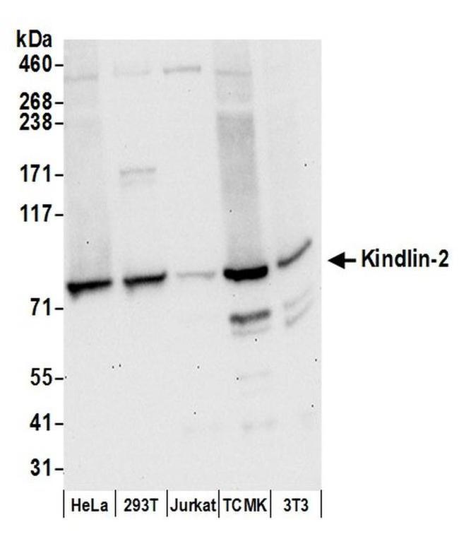 Kindlin-2 Antibody in Western Blot (WB)