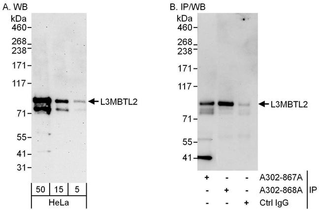 L3MBTL2 Antibody in Western Blot (WB)