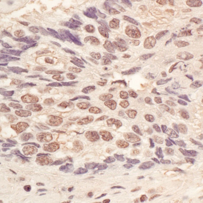 L3MBTL3 Antibody in Immunohistochemistry (IHC)