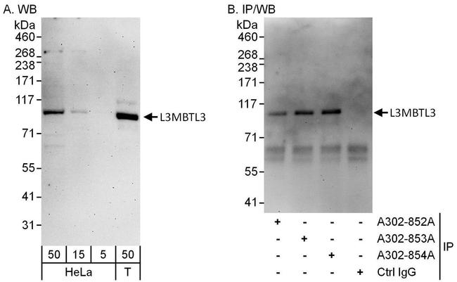 L3MBTL3 Antibody in Western Blot (WB)