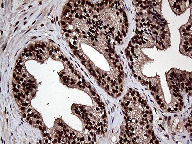 L3MBTL3 Antibody in Immunohistochemistry (Paraffin) (IHC (P))