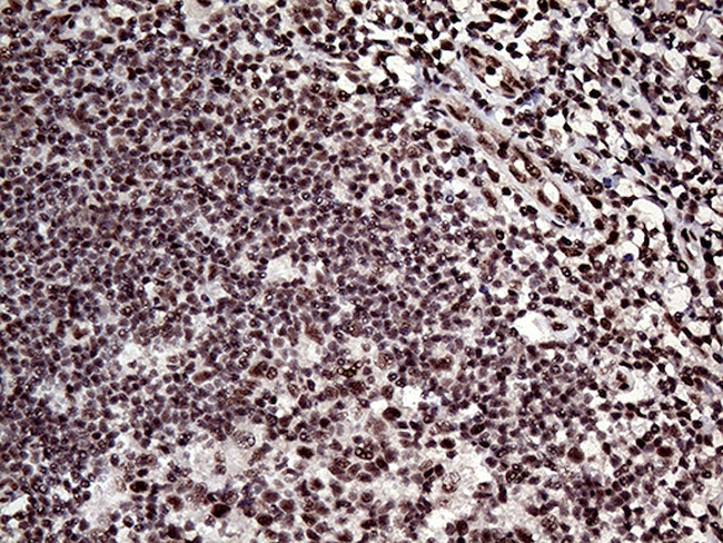 L3MBTL3 Antibody in Immunohistochemistry (Paraffin) (IHC (P))