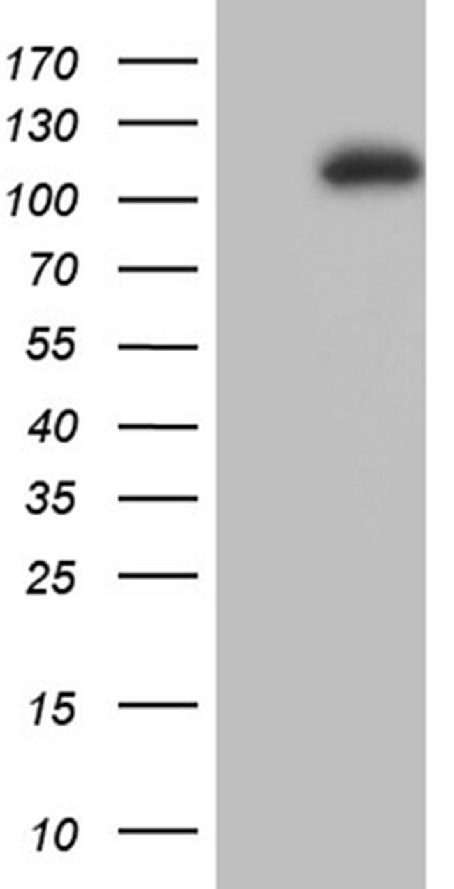 L3MBTL3 Antibody in Western Blot (WB)