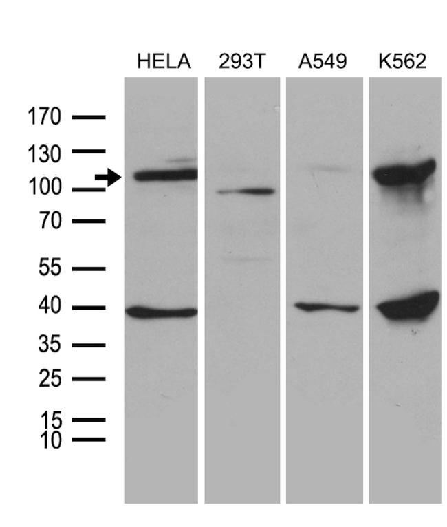 L3MBTL3 Antibody in Western Blot (WB)