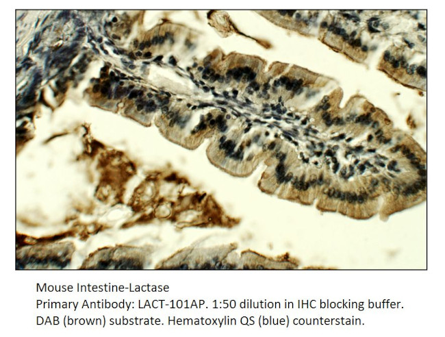 Lactase (LCT) Antibody in Immunohistochemistry (IHC)