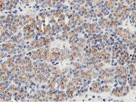 LACTB2 Antibody in Immunohistochemistry (Paraffin) (IHC (P))