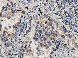 LACTB2 Antibody in Immunohistochemistry (Paraffin) (IHC (P))