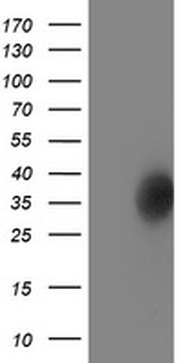 LACTB2 Antibody in Western Blot (WB)