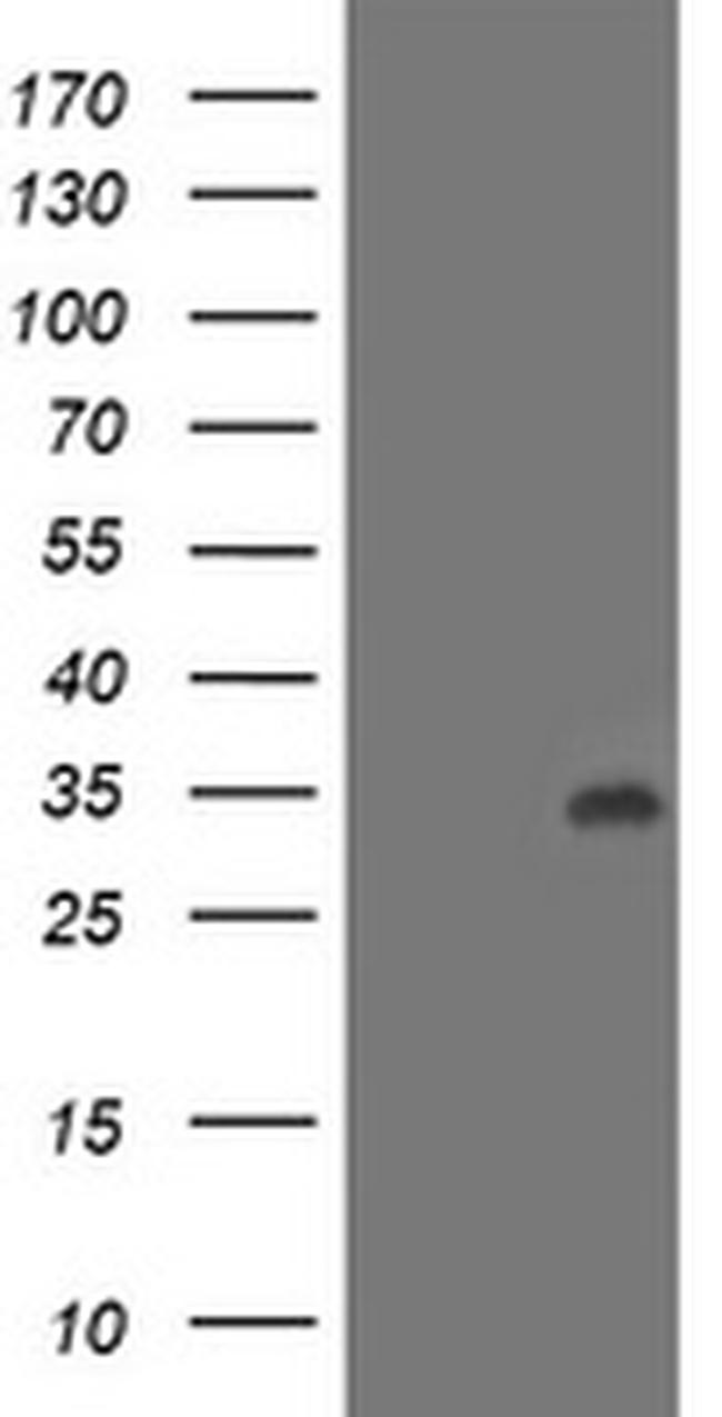 LACTB2 Antibody in Western Blot (WB)