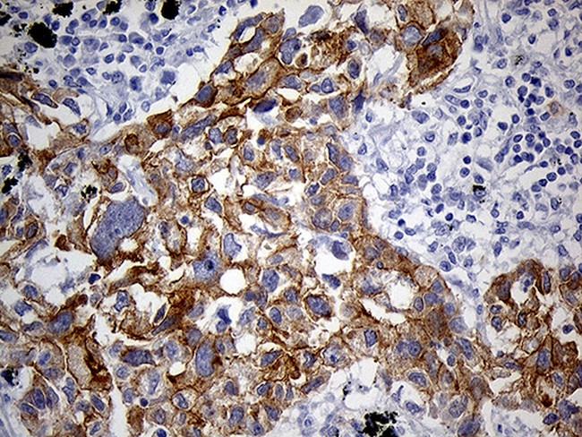 LAD1 Antibody in Immunohistochemistry (Paraffin) (IHC (P))