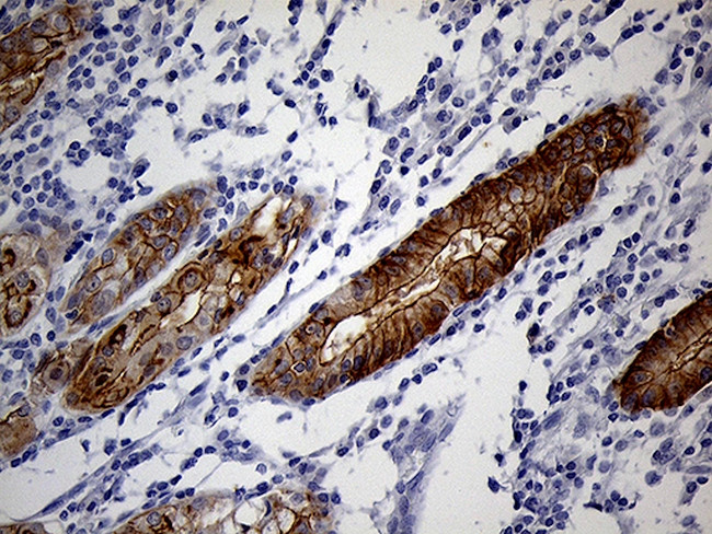 LAD1 Antibody in Immunohistochemistry (Paraffin) (IHC (P))