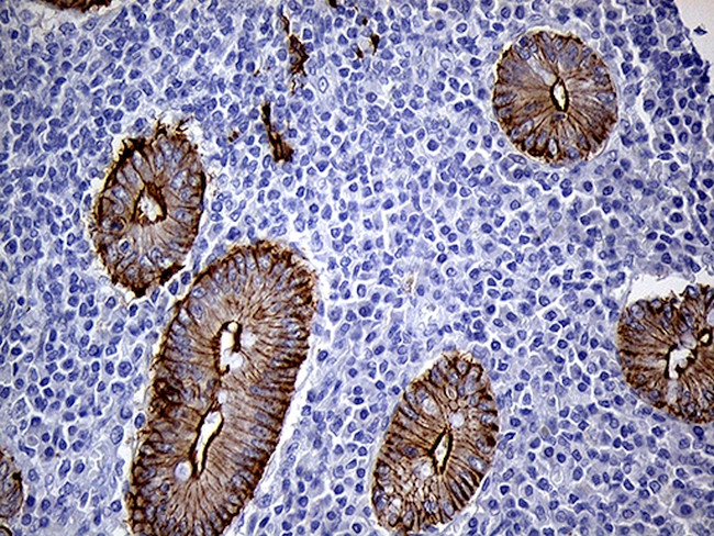 LAD1 Antibody in Immunohistochemistry (Paraffin) (IHC (P))