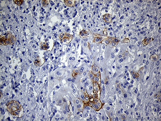 LAD1 Antibody in Immunohistochemistry (Paraffin) (IHC (P))