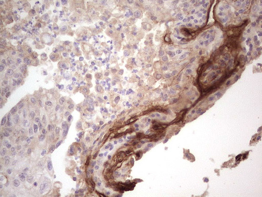 LAMA4 Antibody in Immunohistochemistry (Paraffin) (IHC (P))