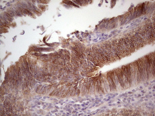 LAMA4 Antibody in Immunohistochemistry (Paraffin) (IHC (P))