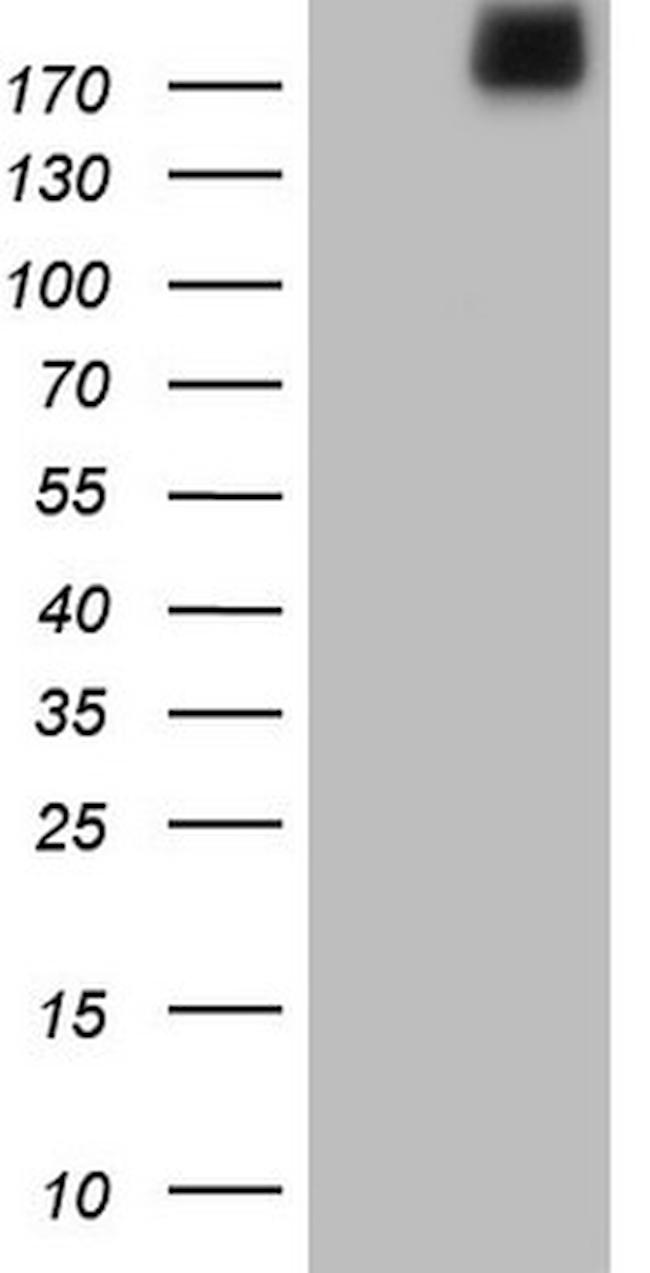 LAMA4 Antibody in Western Blot (WB)