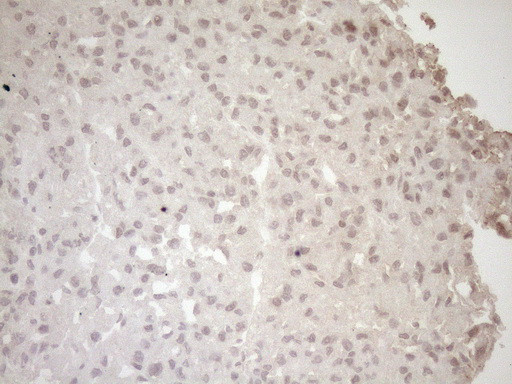 LAMB2 Antibody in Immunohistochemistry (Paraffin) (IHC (P))