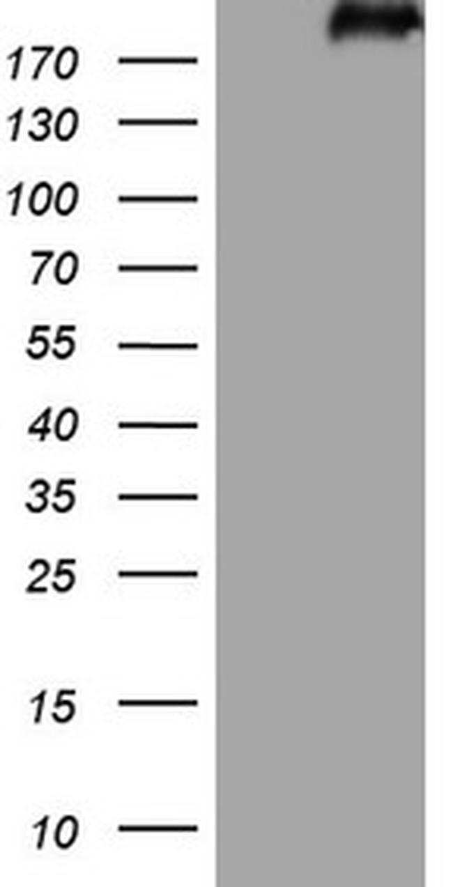 LAMB2 Antibody in Western Blot (WB)