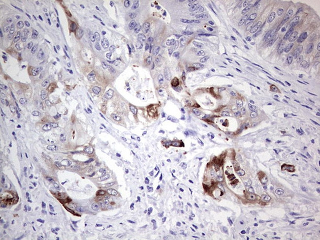 LAMB3 Antibody in Immunohistochemistry (Paraffin) (IHC (P))