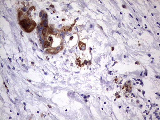 LAMB3 Antibody in Immunohistochemistry (Paraffin) (IHC (P))