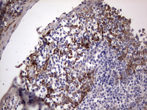 LAMB3 Antibody in Immunohistochemistry (Paraffin) (IHC (P))