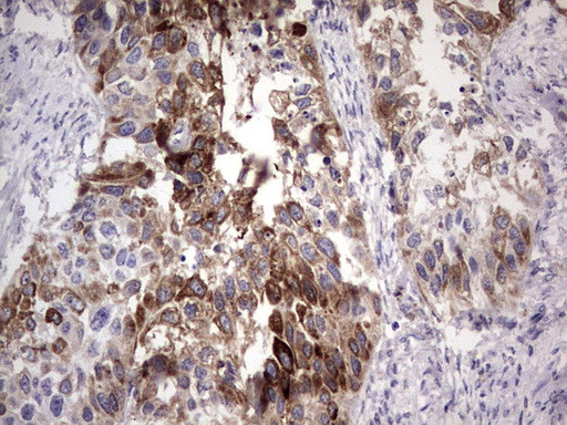 LAMB3 Antibody in Immunohistochemistry (Paraffin) (IHC (P))