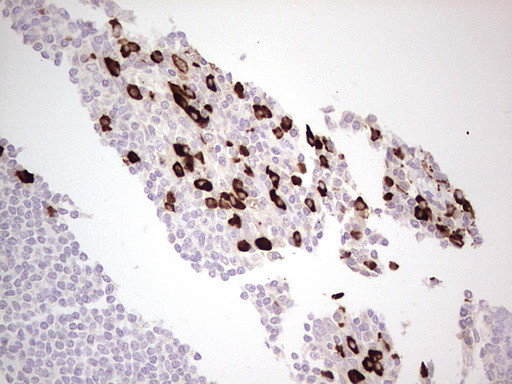 LAMB3 Antibody in Immunohistochemistry (Paraffin) (IHC (P))