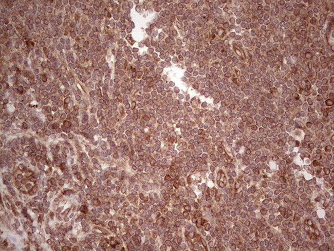 LAMB3 Antibody in Immunohistochemistry (Paraffin) (IHC (P))