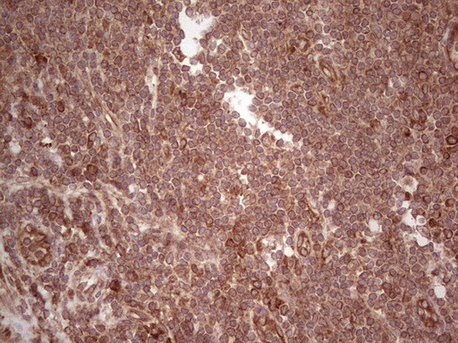 LAMB3 Antibody in Immunohistochemistry (Paraffin) (IHC (P))