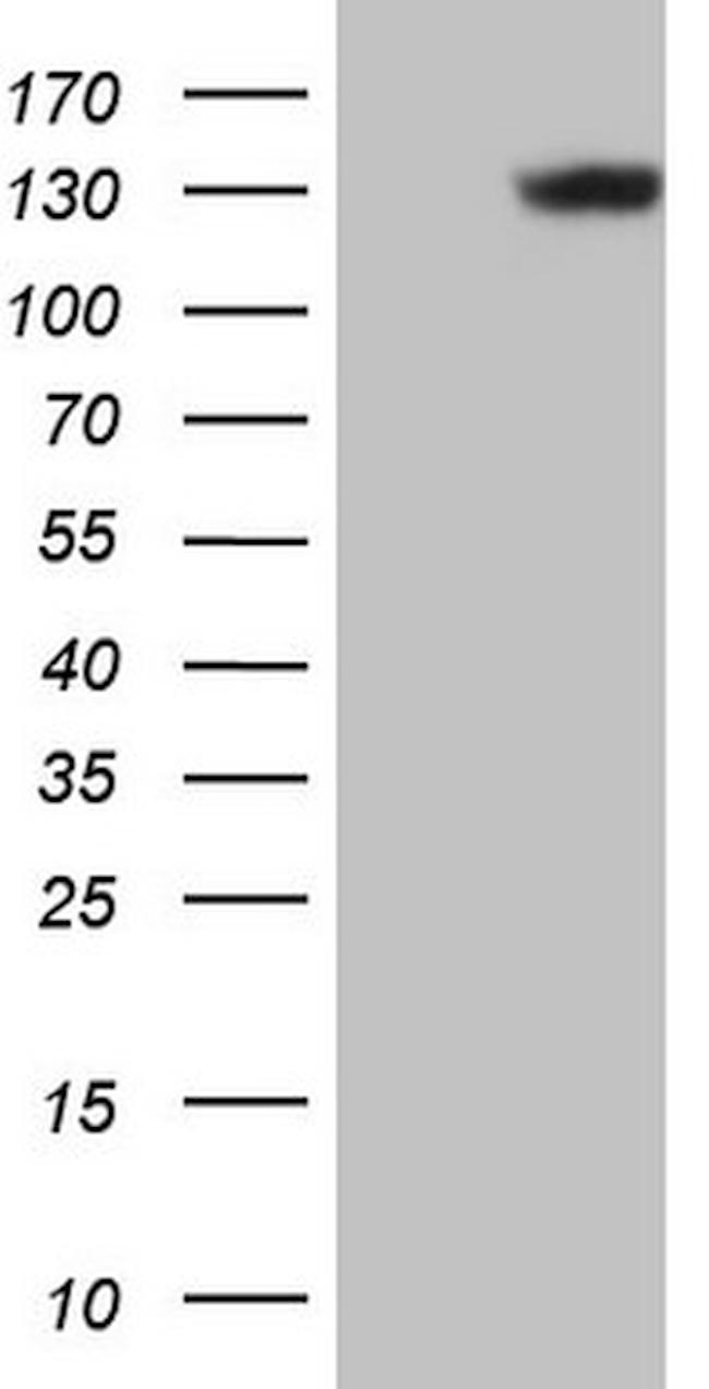 LAMB3 Antibody in Western Blot (WB)