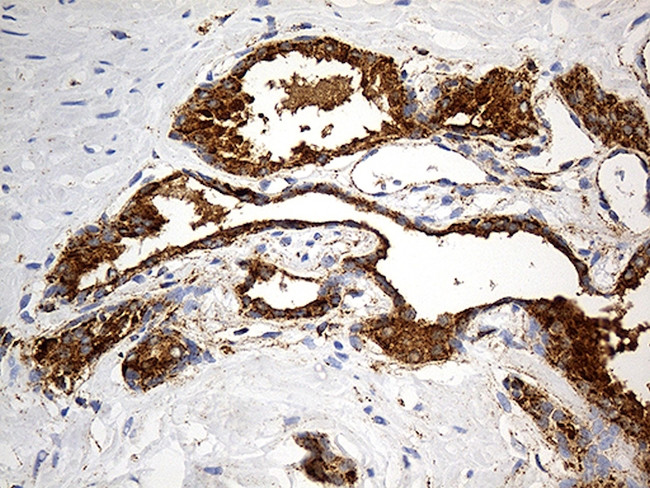 LAMP1 Antibody in Immunohistochemistry (Paraffin) (IHC (P))