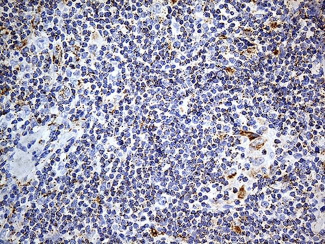 LAMP1 Antibody in Immunohistochemistry (Paraffin) (IHC (P))