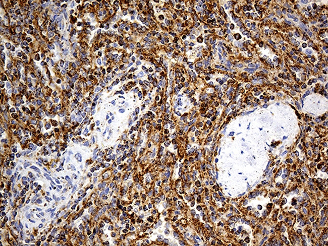 LAMP1 Antibody in Immunohistochemistry (Paraffin) (IHC (P))