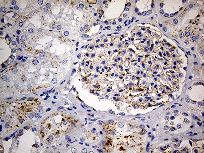 LAMP1 Antibody in Immunohistochemistry (Paraffin) (IHC (P))