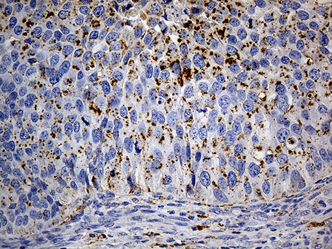 LAMP1 Antibody in Immunohistochemistry (Paraffin) (IHC (P))