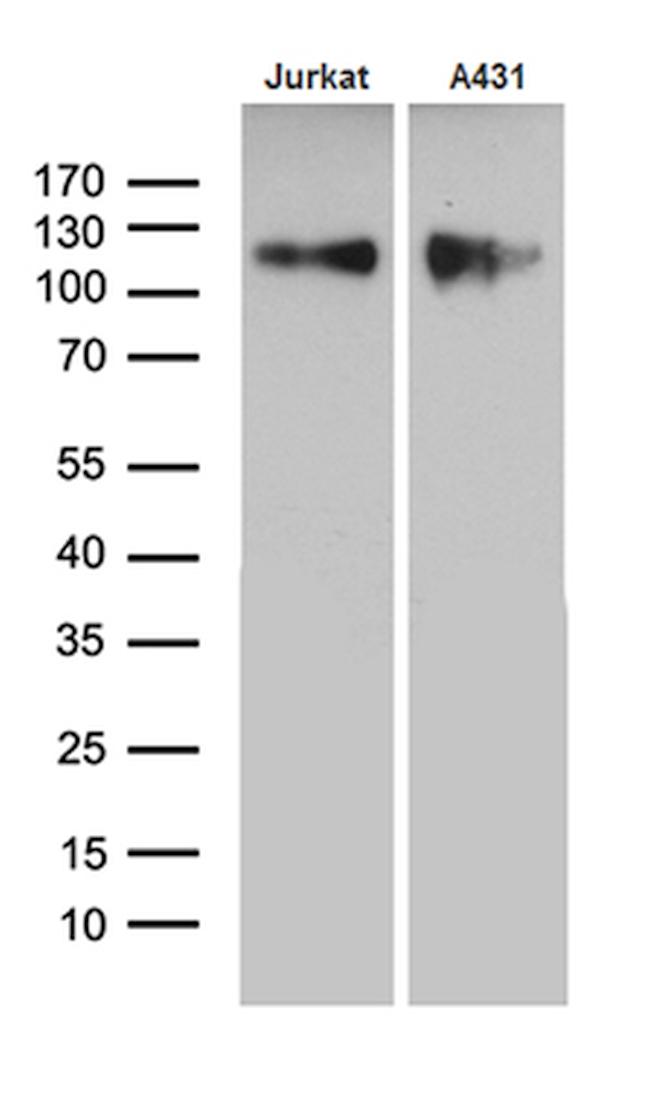 LAMP1 Antibody in Western Blot (WB)