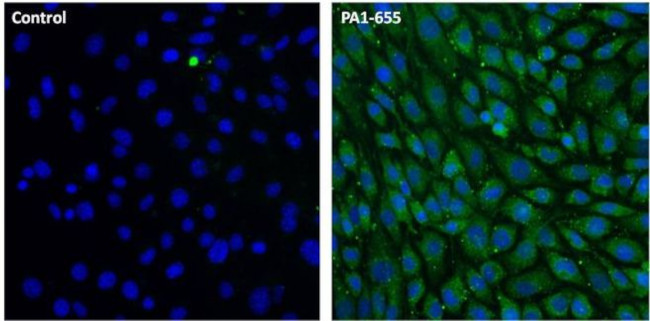 LAMP2 Antibody in Immunocytochemistry (ICC/IF)