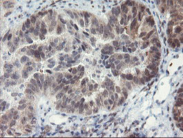 LANCL2 Antibody in Immunohistochemistry (Paraffin) (IHC (P))