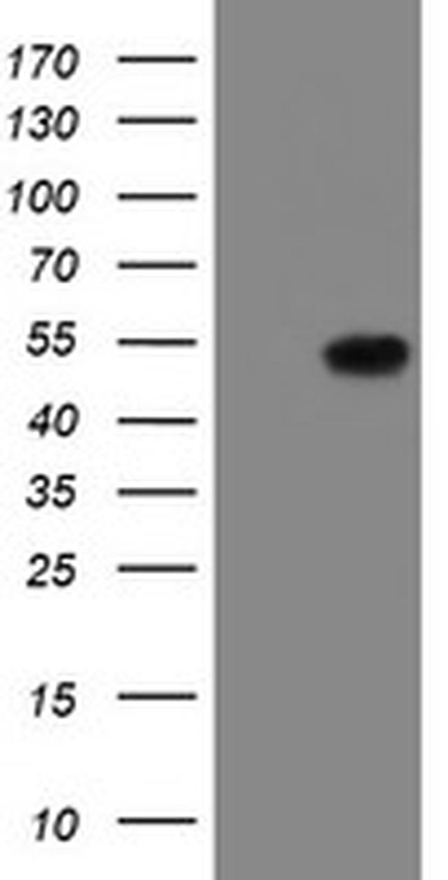 LANCL2 Antibody in Western Blot (WB)