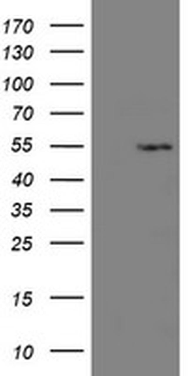 LANCL2 Antibody in Western Blot (WB)