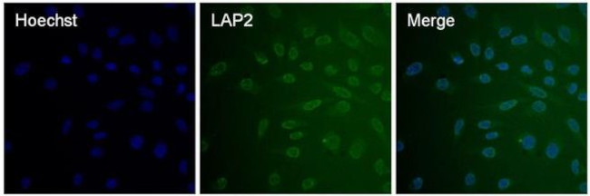 LAP2 Antibody in Immunocytochemistry (ICC/IF)