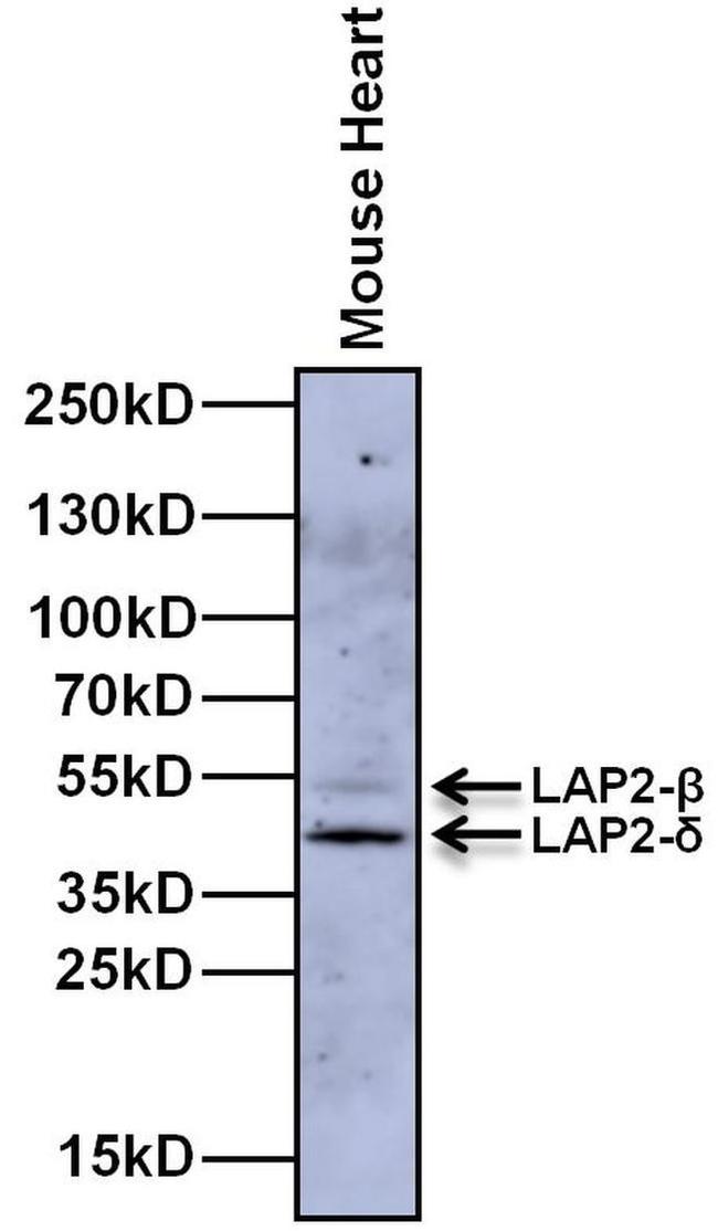 LAP2 Antibody in Western Blot (WB)