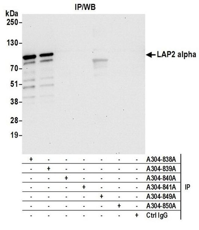 LAP2 alpha/TMPO Antibody in Western Blot (WB)