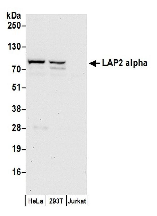 LAP2 alpha/TMPO Antibody in Western Blot (WB)