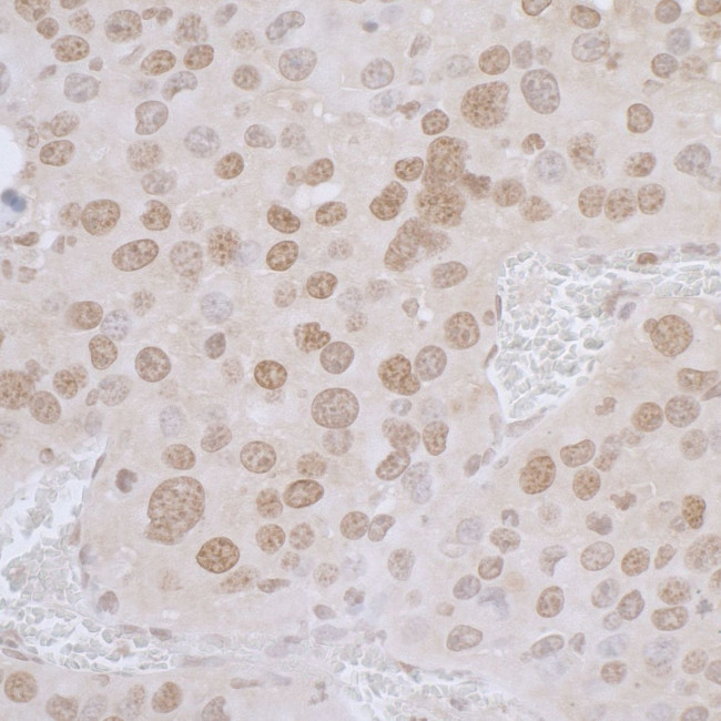 LAP2 alpha/TMPO Antibody in Immunohistochemistry (IHC)