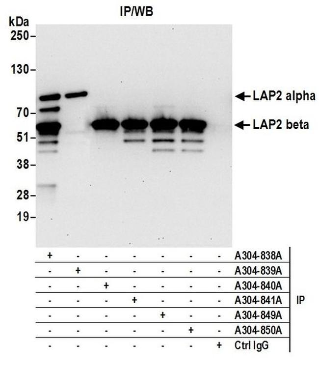 LAP2 alpha beta gamma/TMPO Antibody in Western Blot (WB)