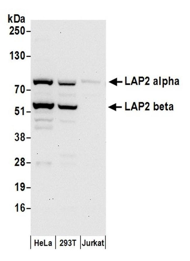 LAP2 alpha beta gamma/TMPO Antibody in Western Blot (WB)