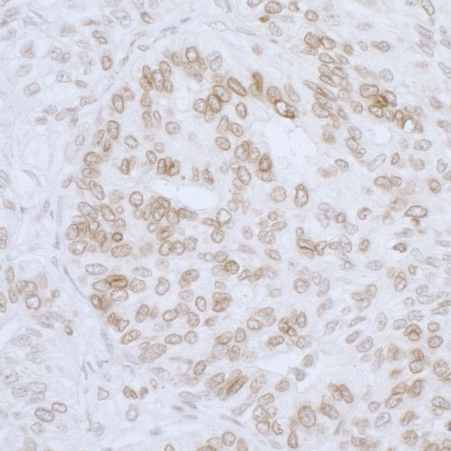 LAP2 beta/TMPO Antibody in Immunohistochemistry (IHC)