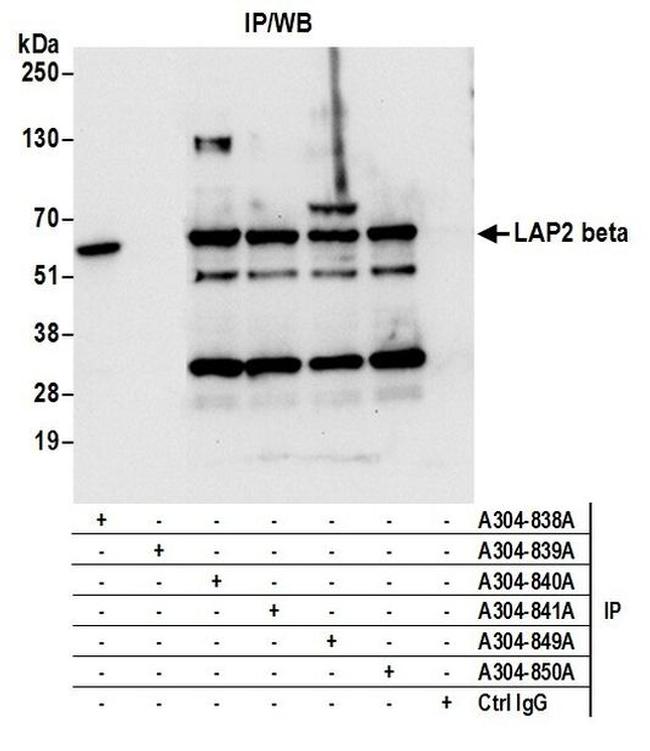 LAP2 beta/TMPO Antibody in Western Blot (WB)