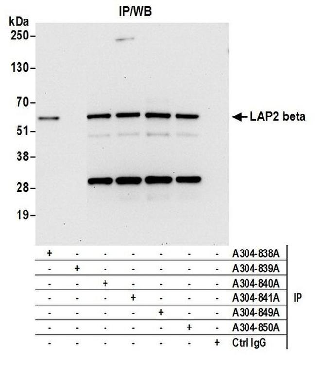 LAP2 beta/TMPO Antibody in Western Blot (WB)